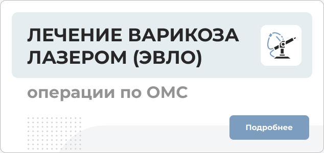 Лечение варикоза
