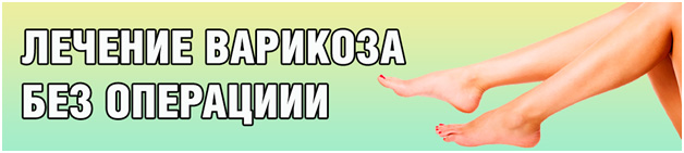 лечение вен