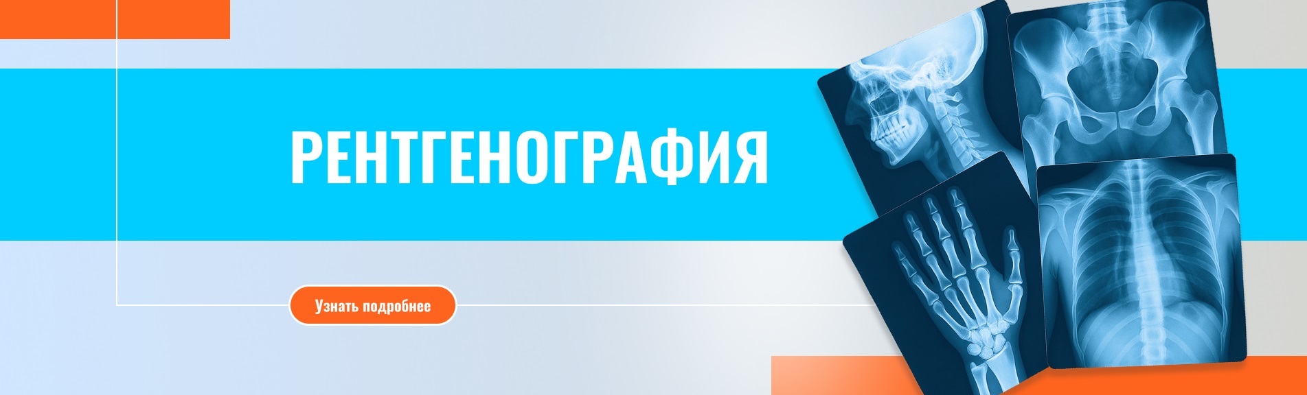 Рентгенография